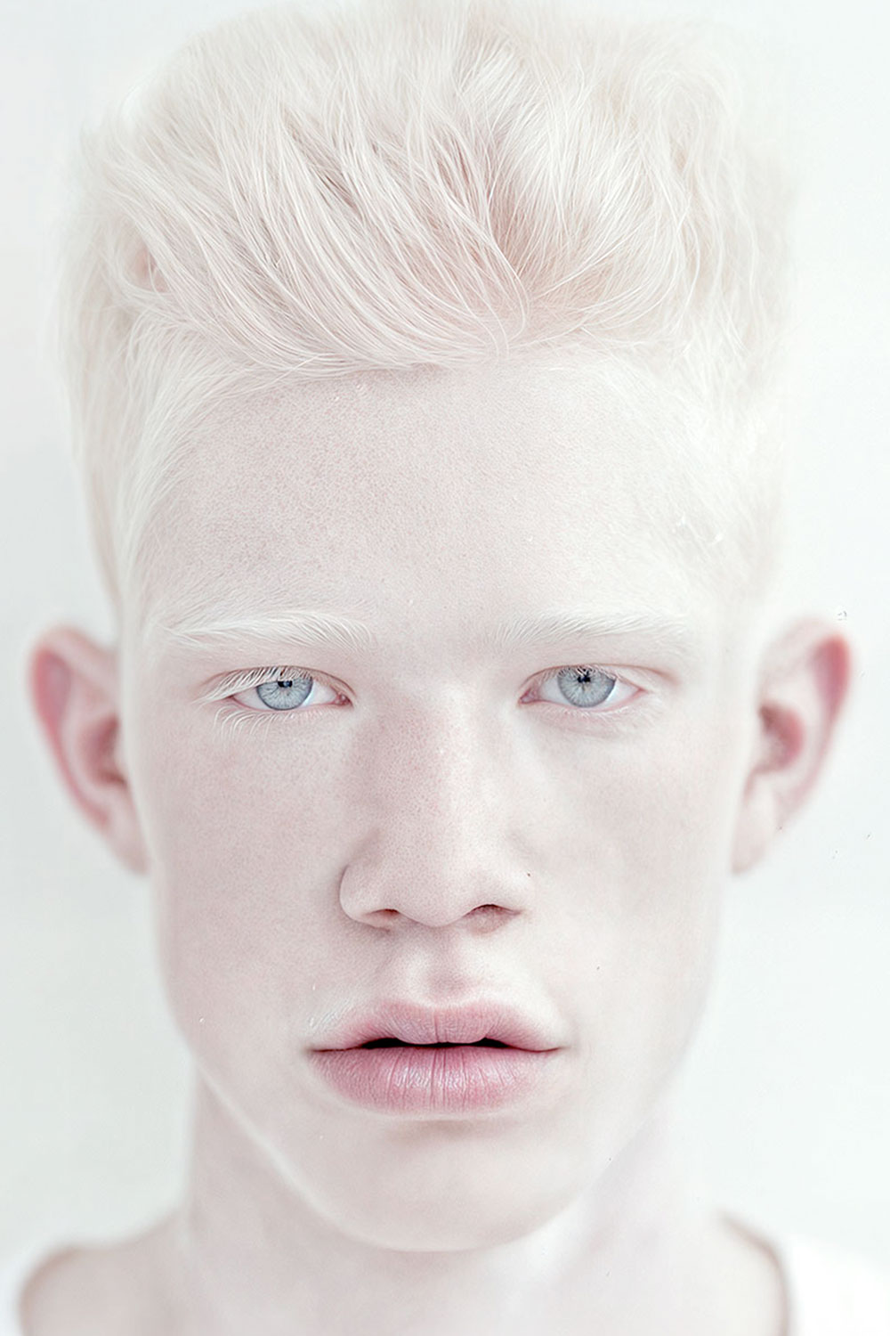 albin_2